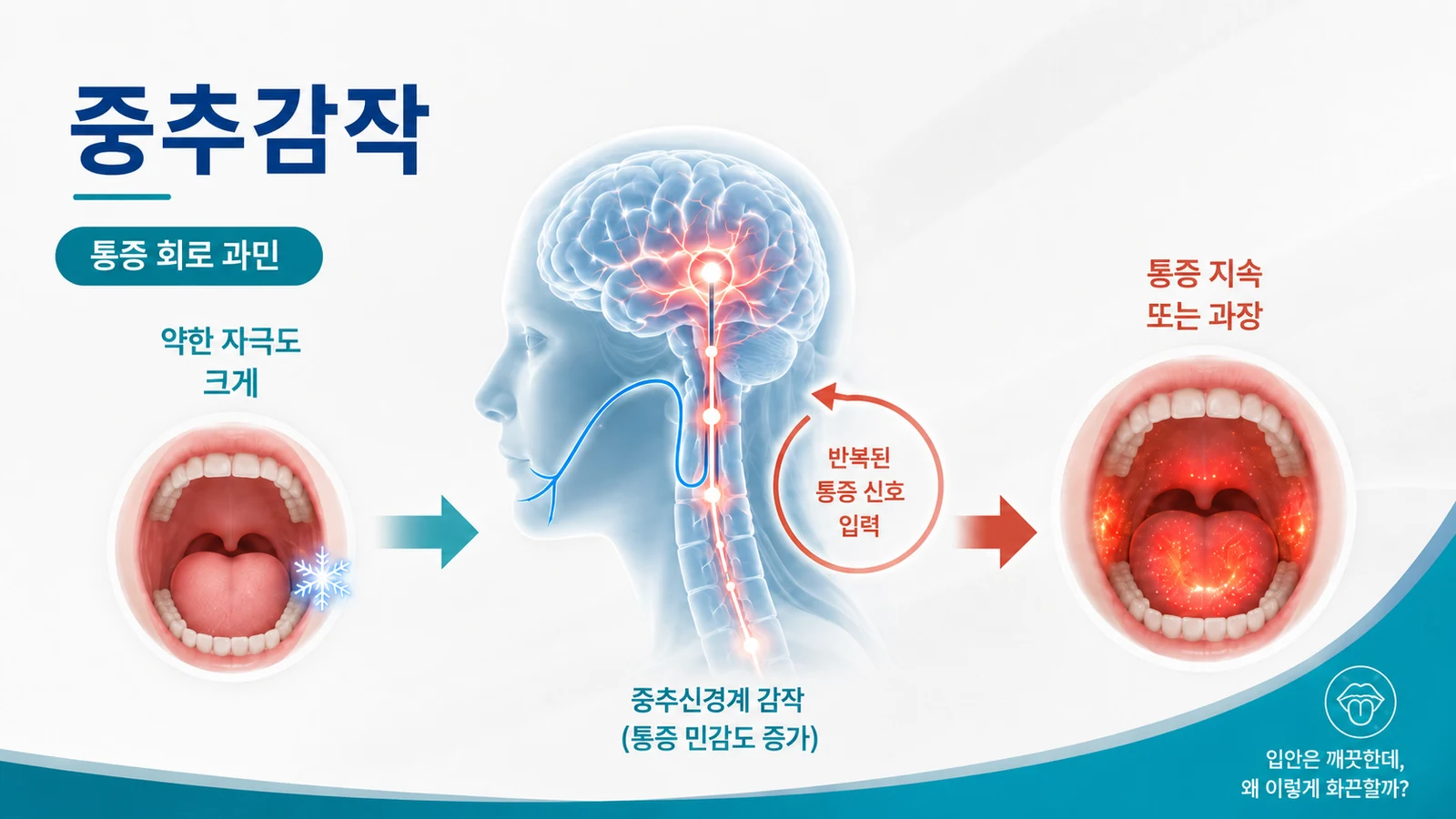 중추감작 — 반복된 통증 신호로 통증 회로가 과민해지는 과정