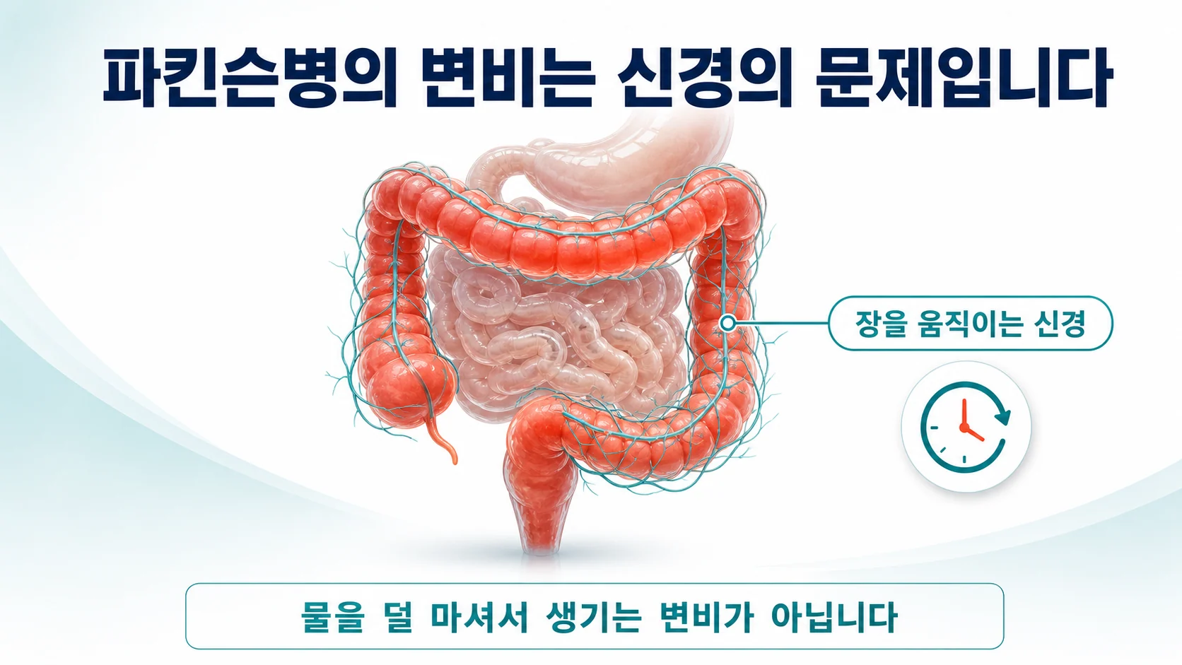 송도 이레한의원에서 파킨슨병 환자의 변비 관리를 설명하는 안내 이미지