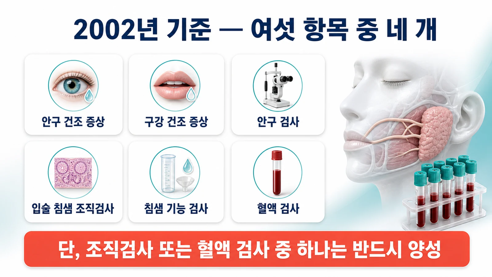 2002년 AECG 기준의 여섯 항목과 네 개 이상 충족 규칙, 그리고 조직검사나 혈액검사 중 하나는 반드시 양성이어야 한다는 필수 조건을 설명하는 인포그래픽