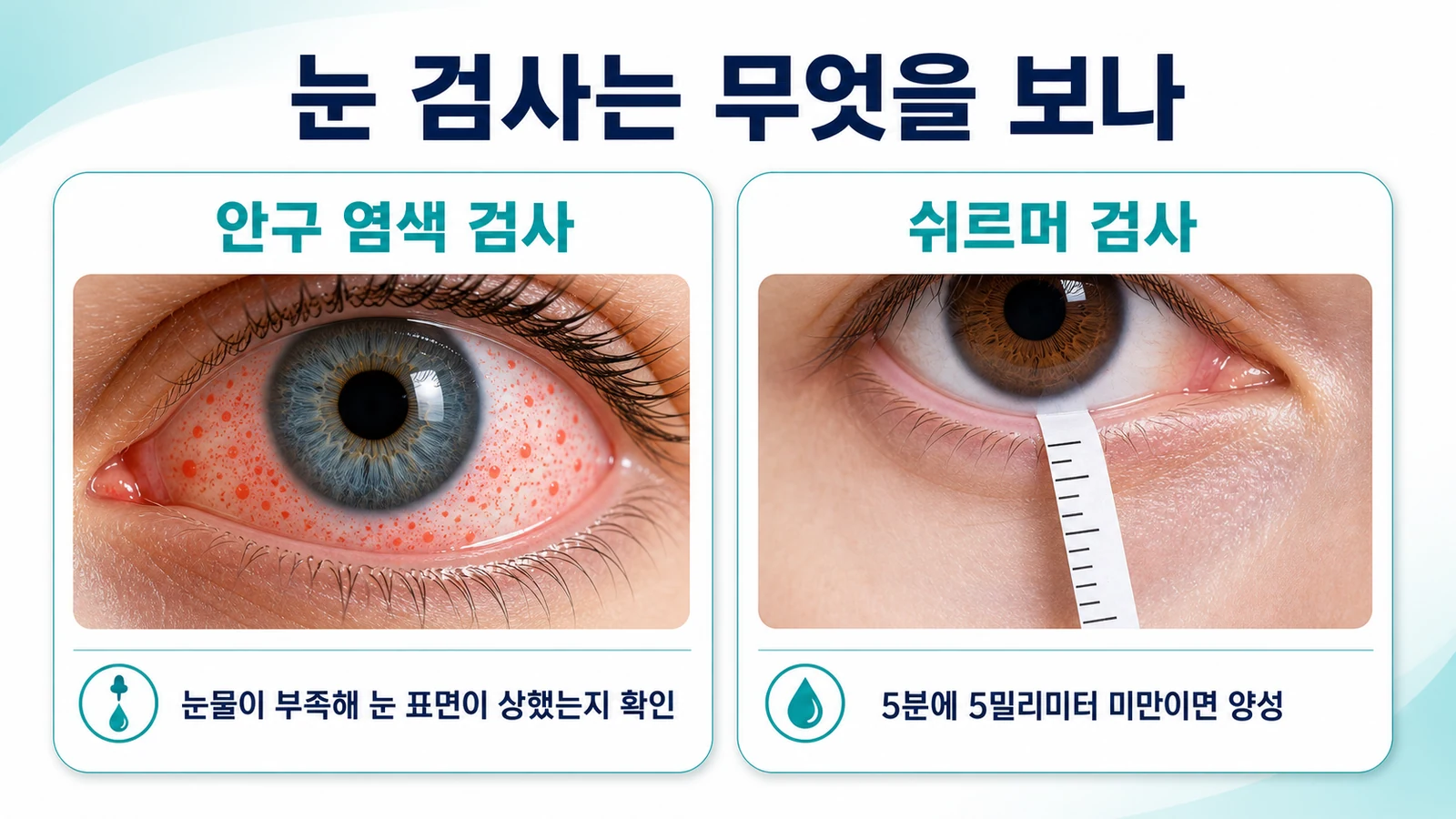 안구 염색 검사와 쉬르머 검사가 각각 무엇을 측정하는지 설명하는 인포그래픽