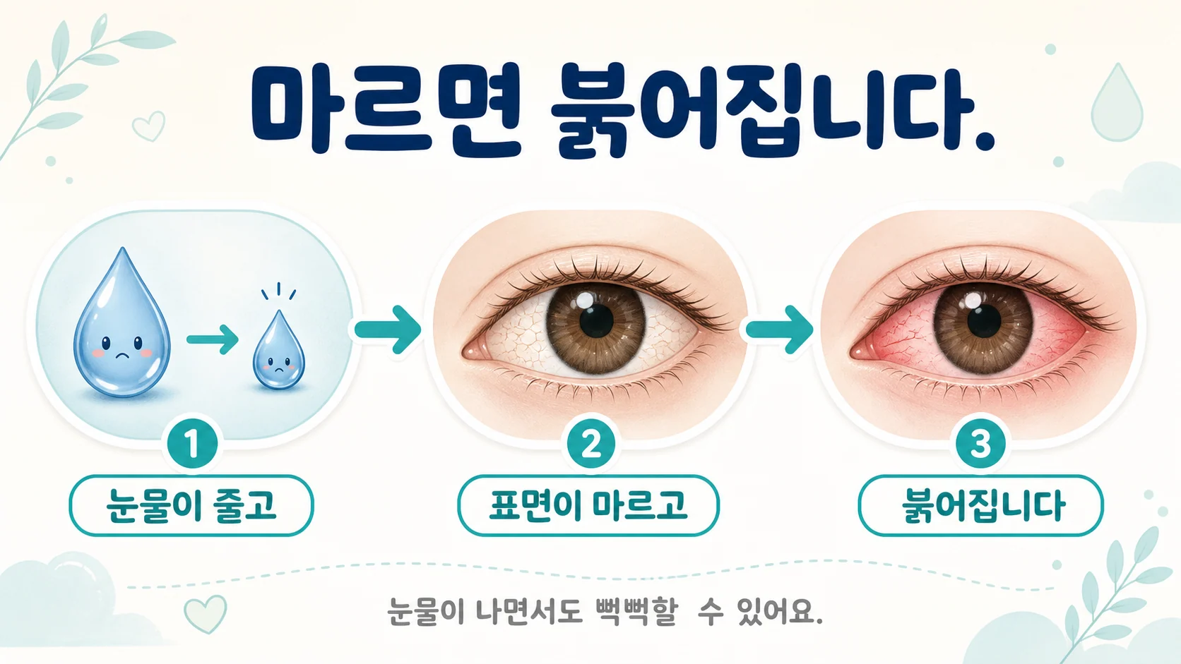 눈물 부족으로 눈 표면에 염증이 생겨 흰자위가 붉어지는 과정을 설명하는 이미지