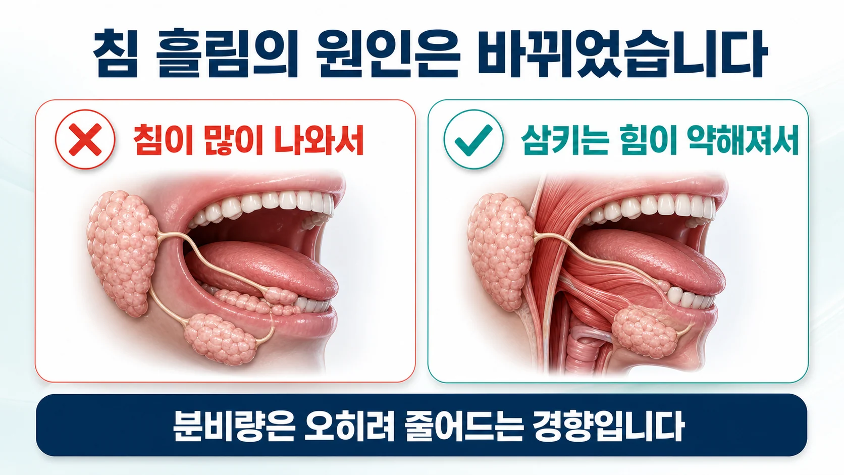 인천 이레한의원에서 파킨슨병 환자의 침 흘림 원인을 설명하는 안내 이미지