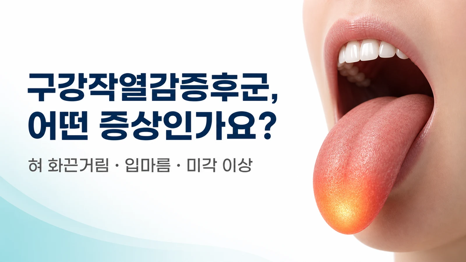 구강작열감증후군 증상 — 혀 화끈거림·입마름·미각 이상, 어떤 느낌인가요