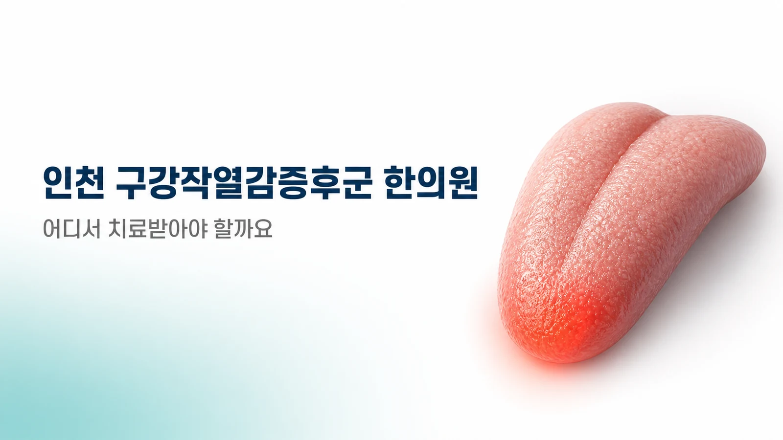 구강작열감증후군, 어디서 치료받아야 할까요