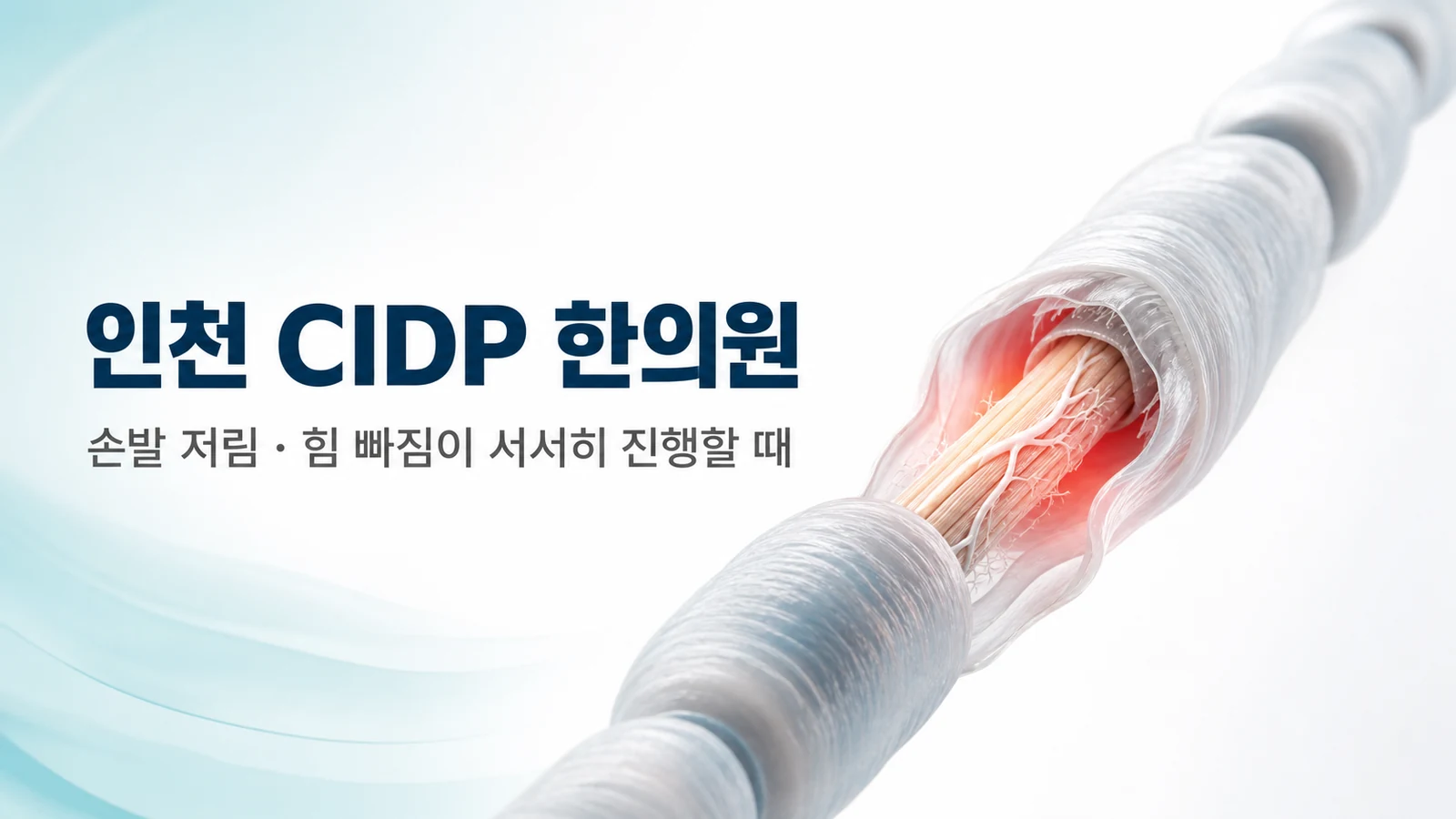 CIDP — 손발 저림·힘 빠짐이 서서히 진행할 때