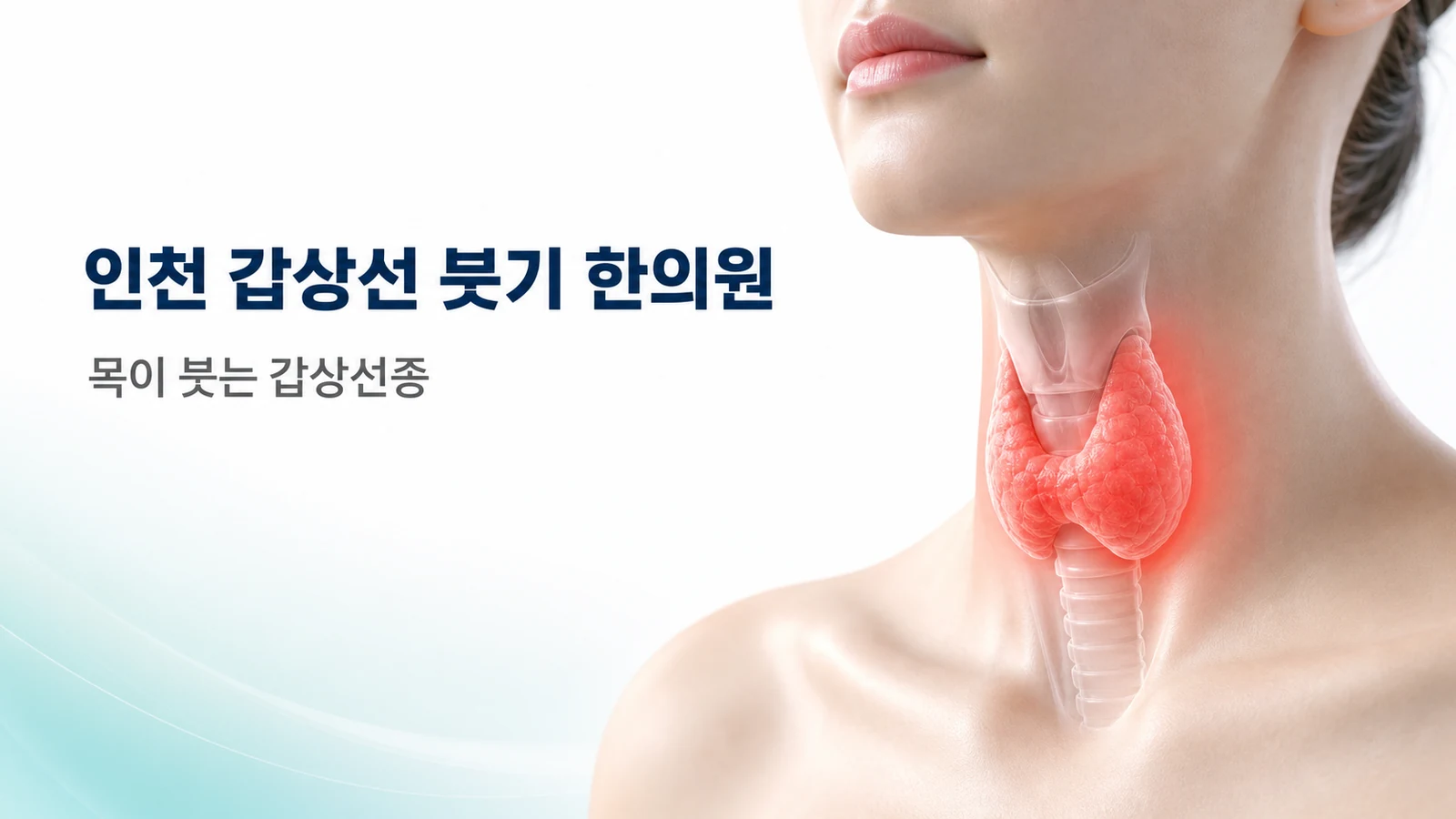 갑상선 붓기 — 목이 붓는 갑상선종, 원인과 관리