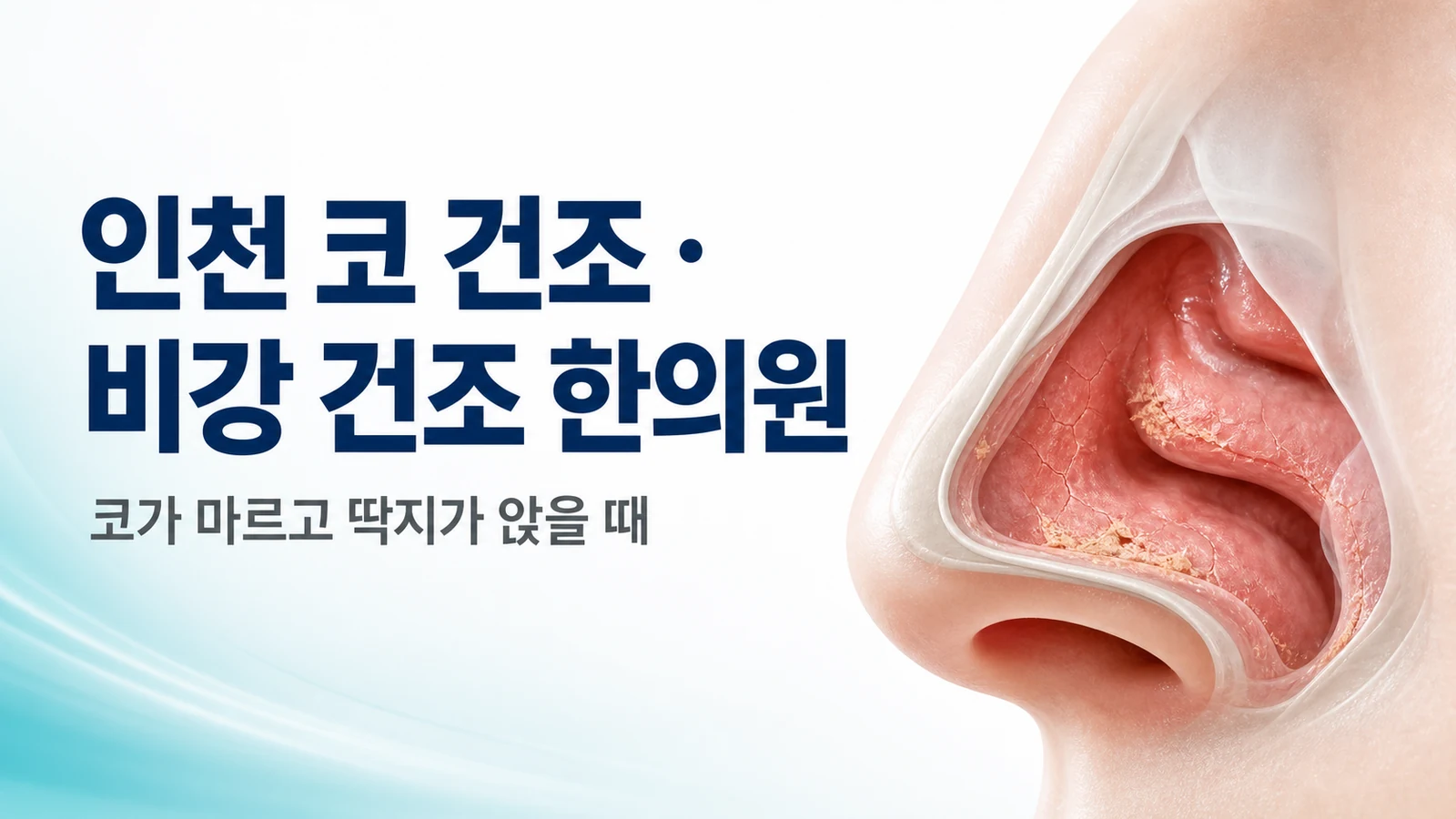 코 건조·비강 건조 — 코가 마르고 딱지가 앉을 때 치료