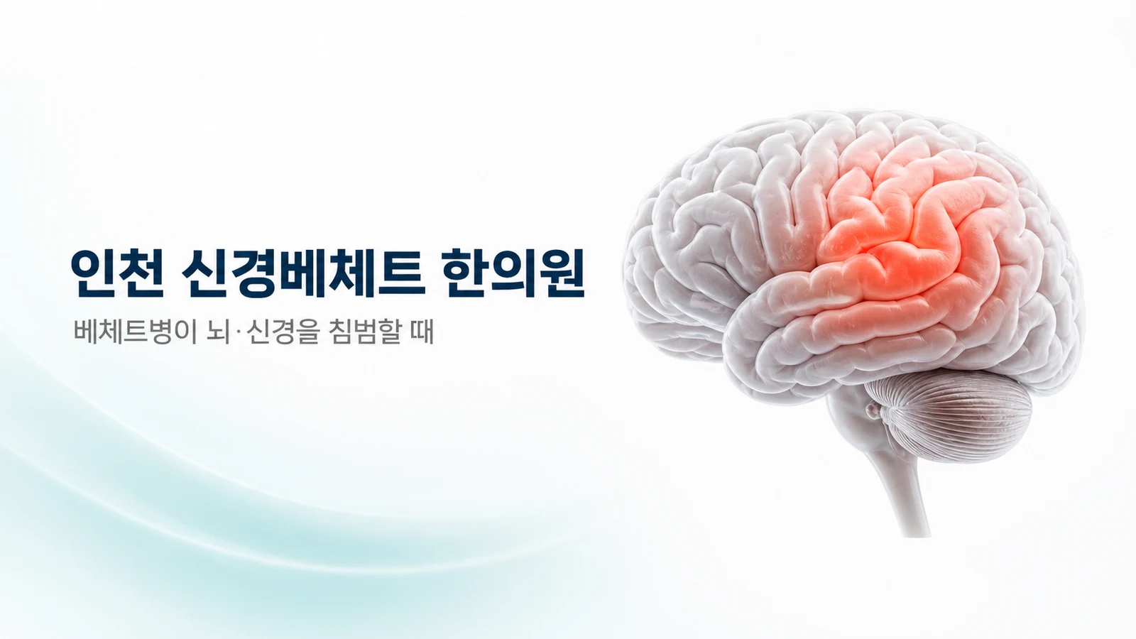 신경베체트 — 베체트병이 뇌·신경을 침범할 때