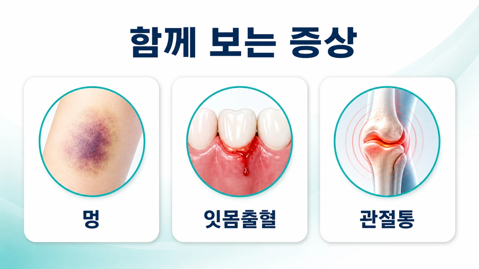다리에 붉은 점상 출혈이 생길 때