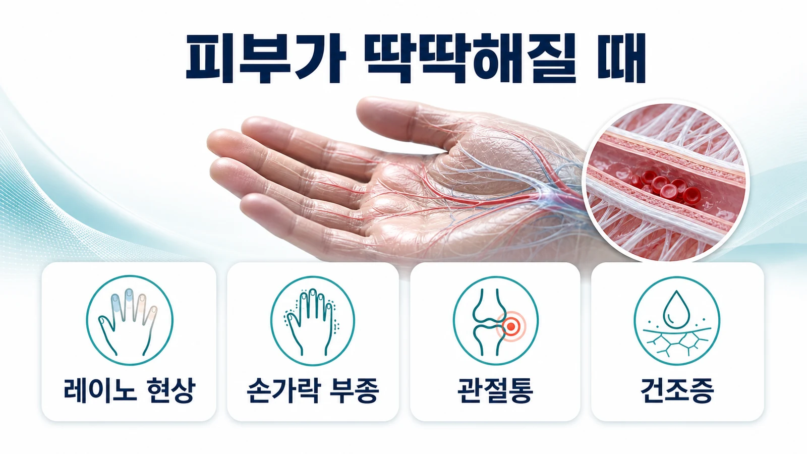 피부가 딱딱해질 때