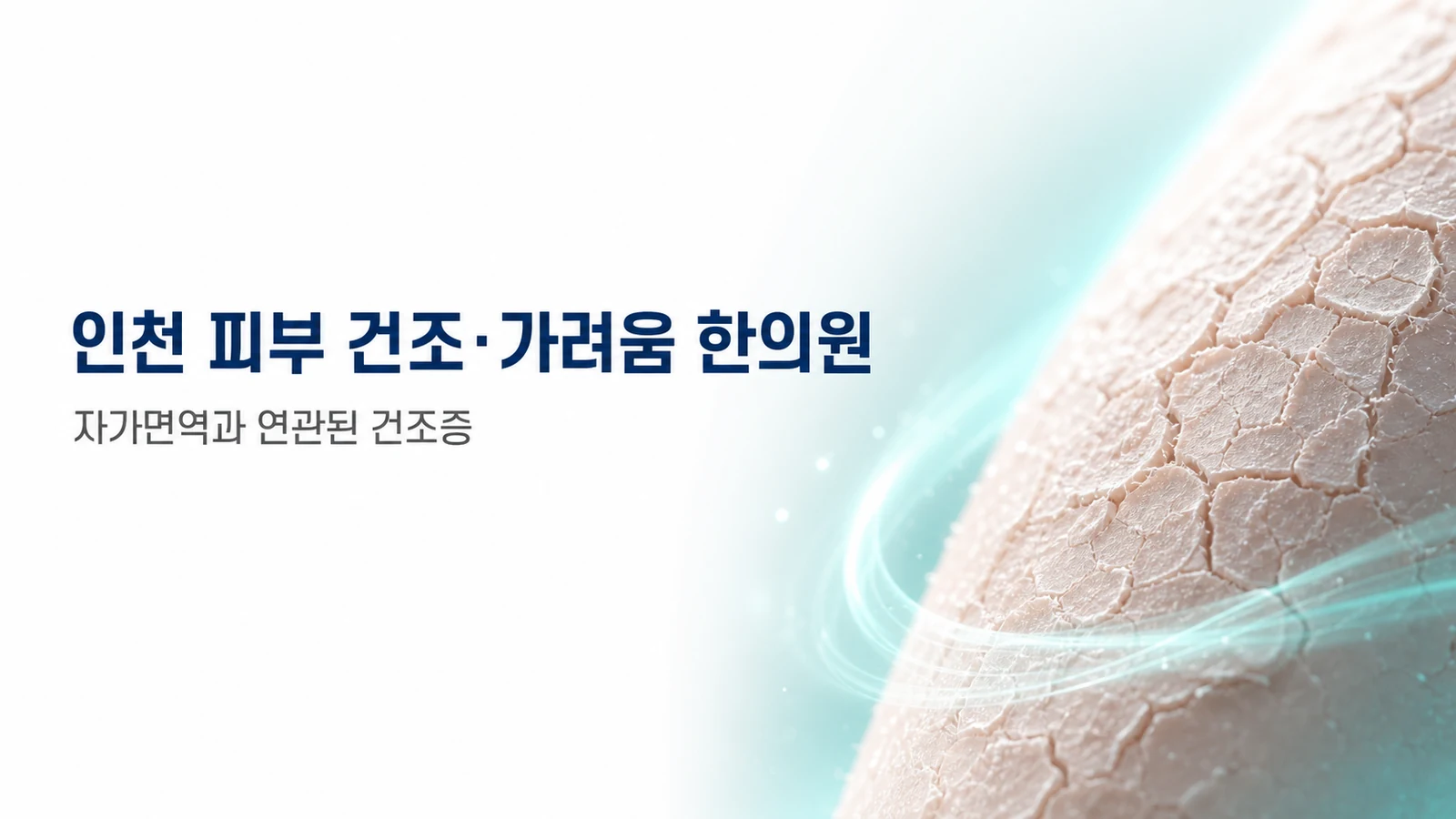 피부 건조 가려움 — 자가면역과 연관된 건조증 치료