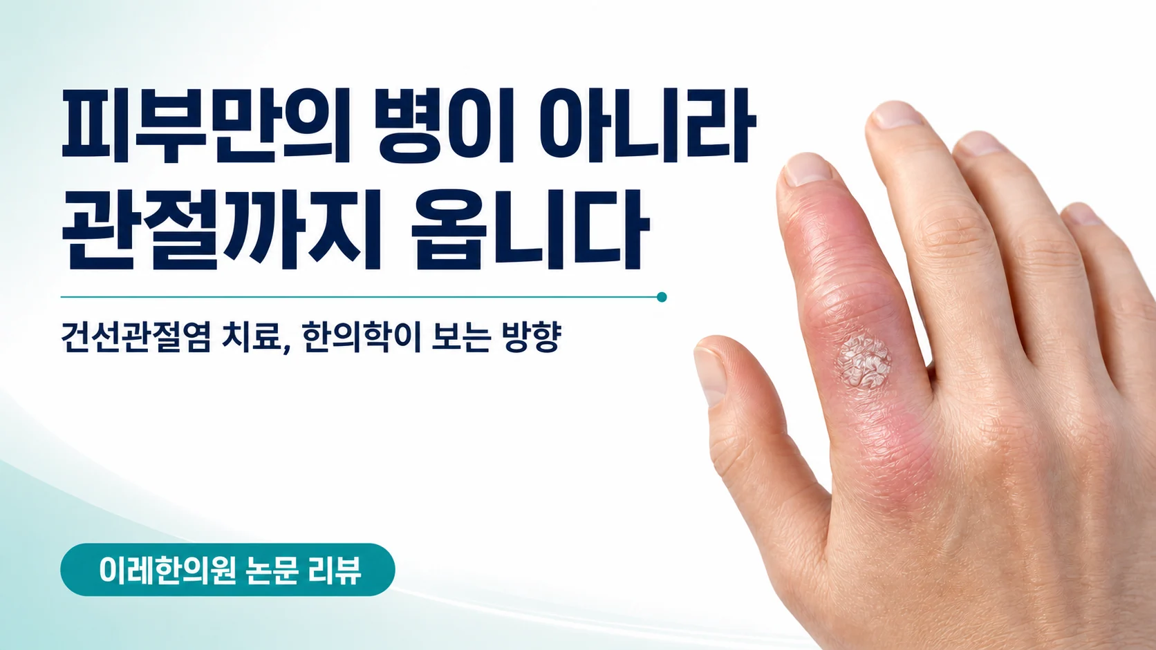 피부만의 병이 아니라 관절까지 온다는 주제의 건선관절염 글 표지 이미지