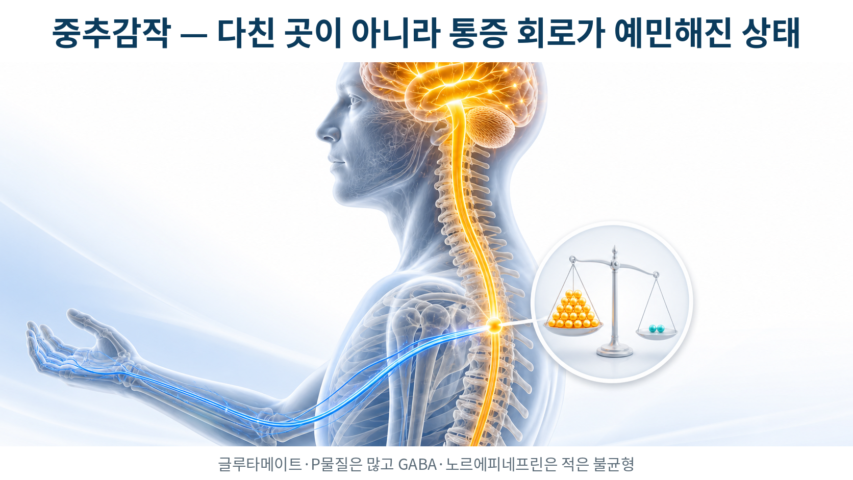 말초 신호는 정상인데 척수와 뇌에서 통증 신호가 증폭되는 중추감작 경로를 표현한 3D 의료 일러스트