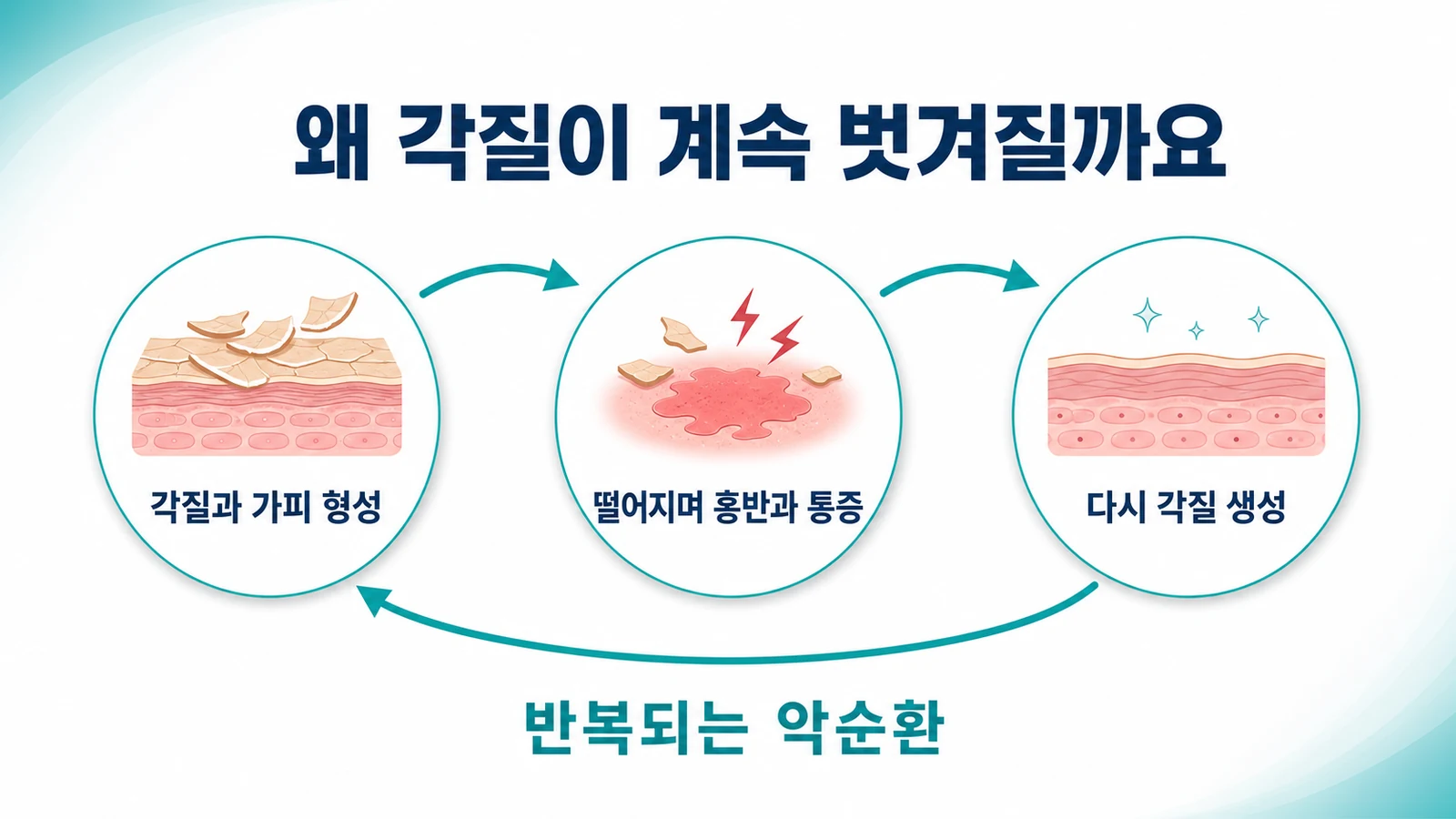 입술 각질이 생기고 떨어지며 다시 생기는 반복 악순환을 나타낸 그림