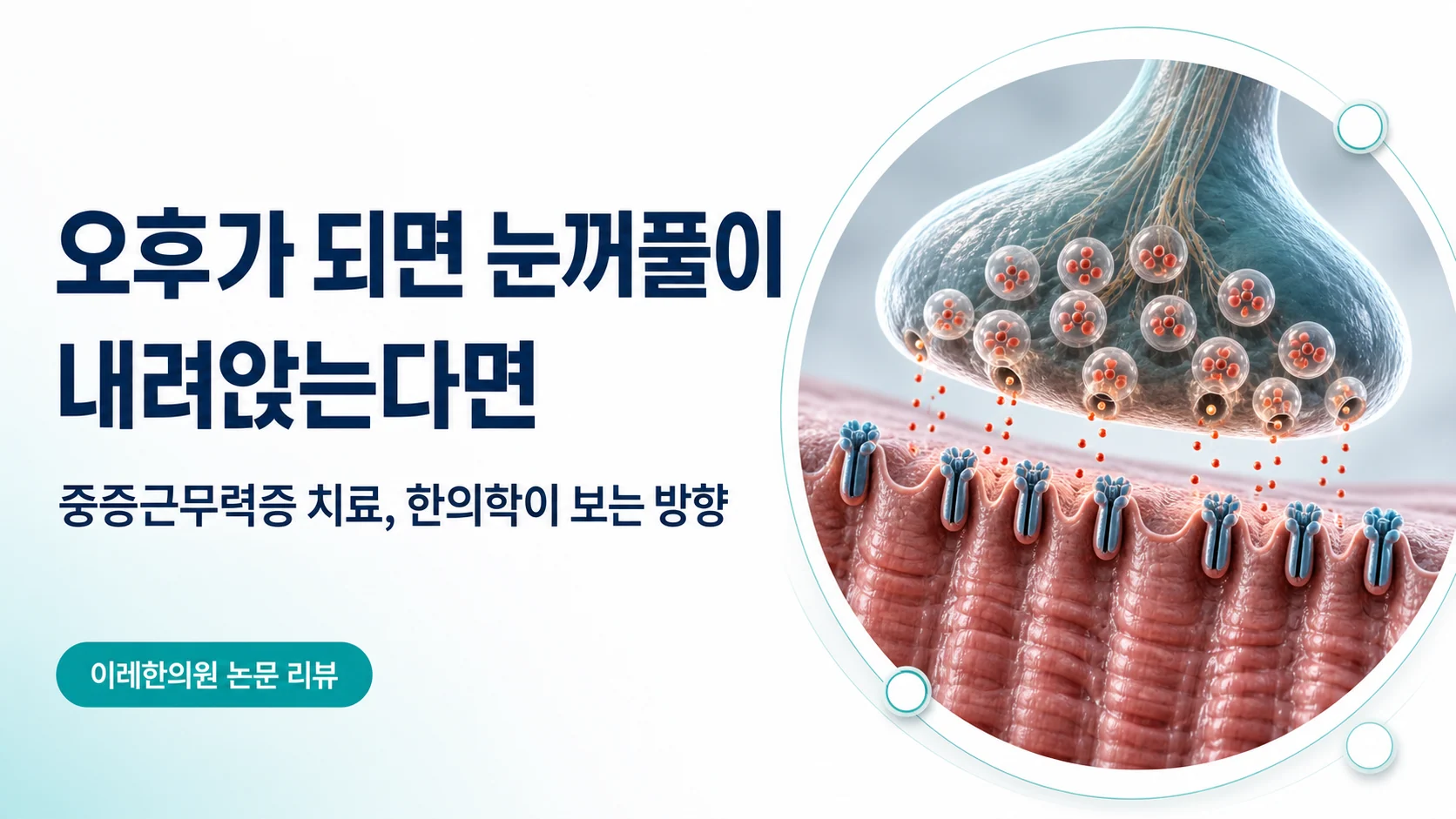 오후가 되면 눈꺼풀이 내려앉는 증상을 다루는 중증근무력증 글의 표지 이미지