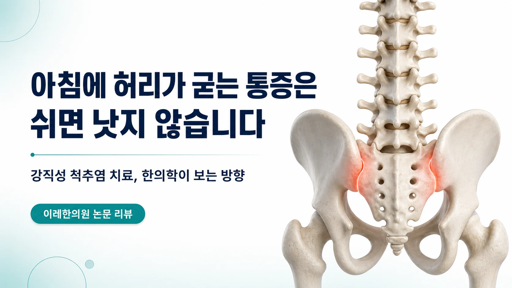 강직성 척추염 — 아침에 굳는 허리, 쉬면 낫지 않습니다