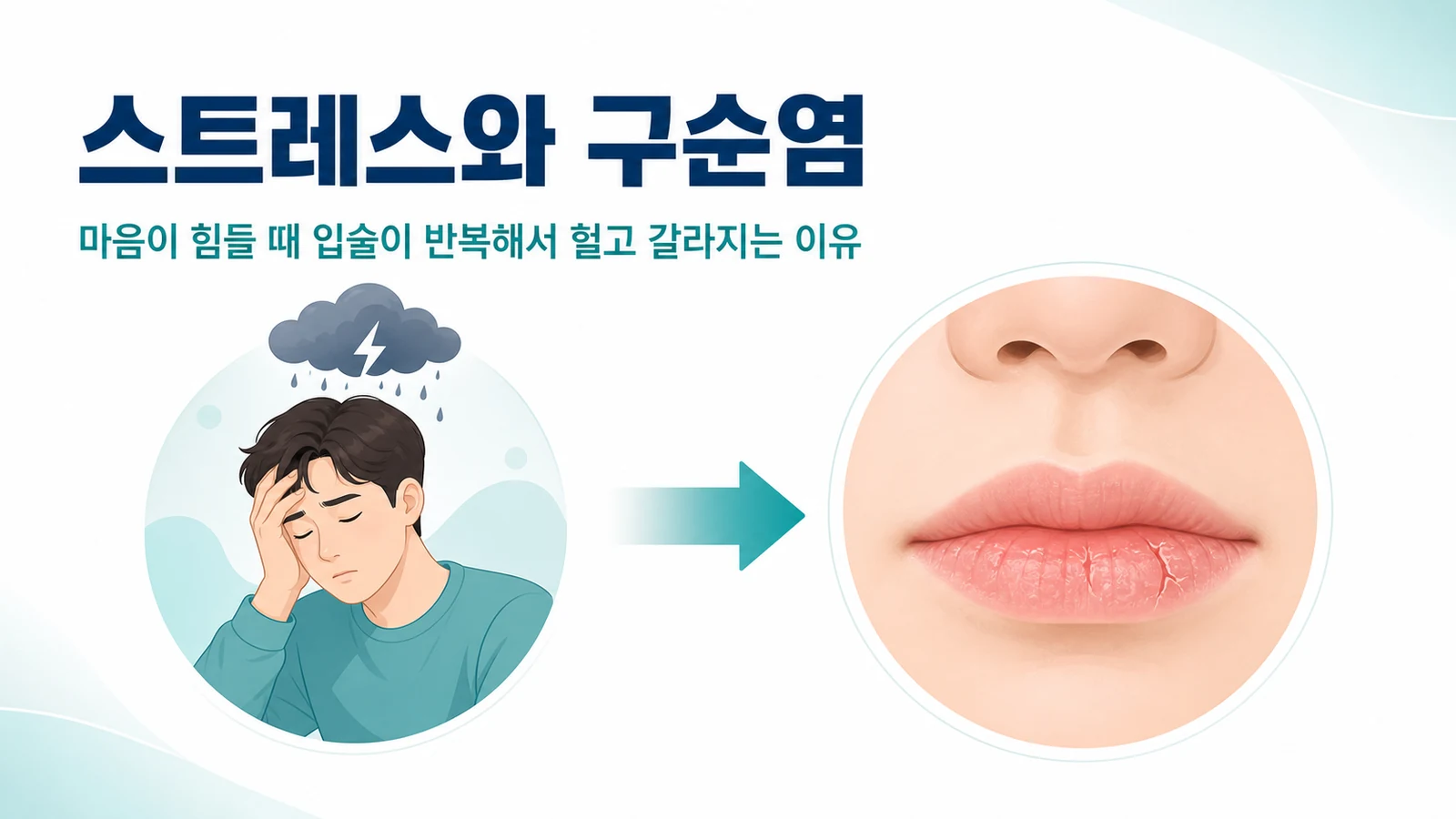 구순염 원인이 스트레스일 때 — 반복되는 입술 염증 치료