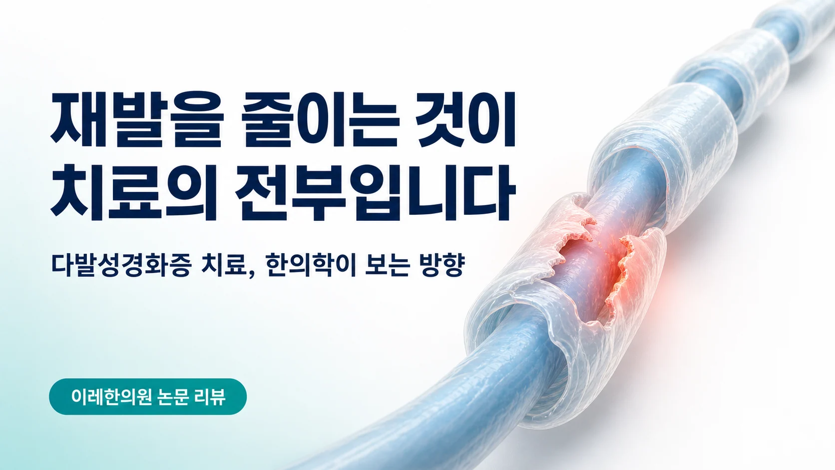 다발성경화증 — 재발을 줄이는 것이 치료의 전부입니다