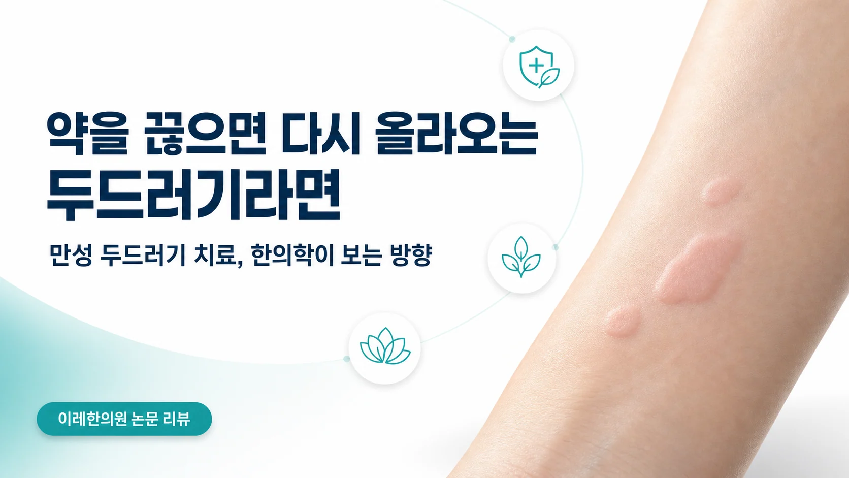 만성 두드러기 — 약을 끊으면 다시 올라온다면