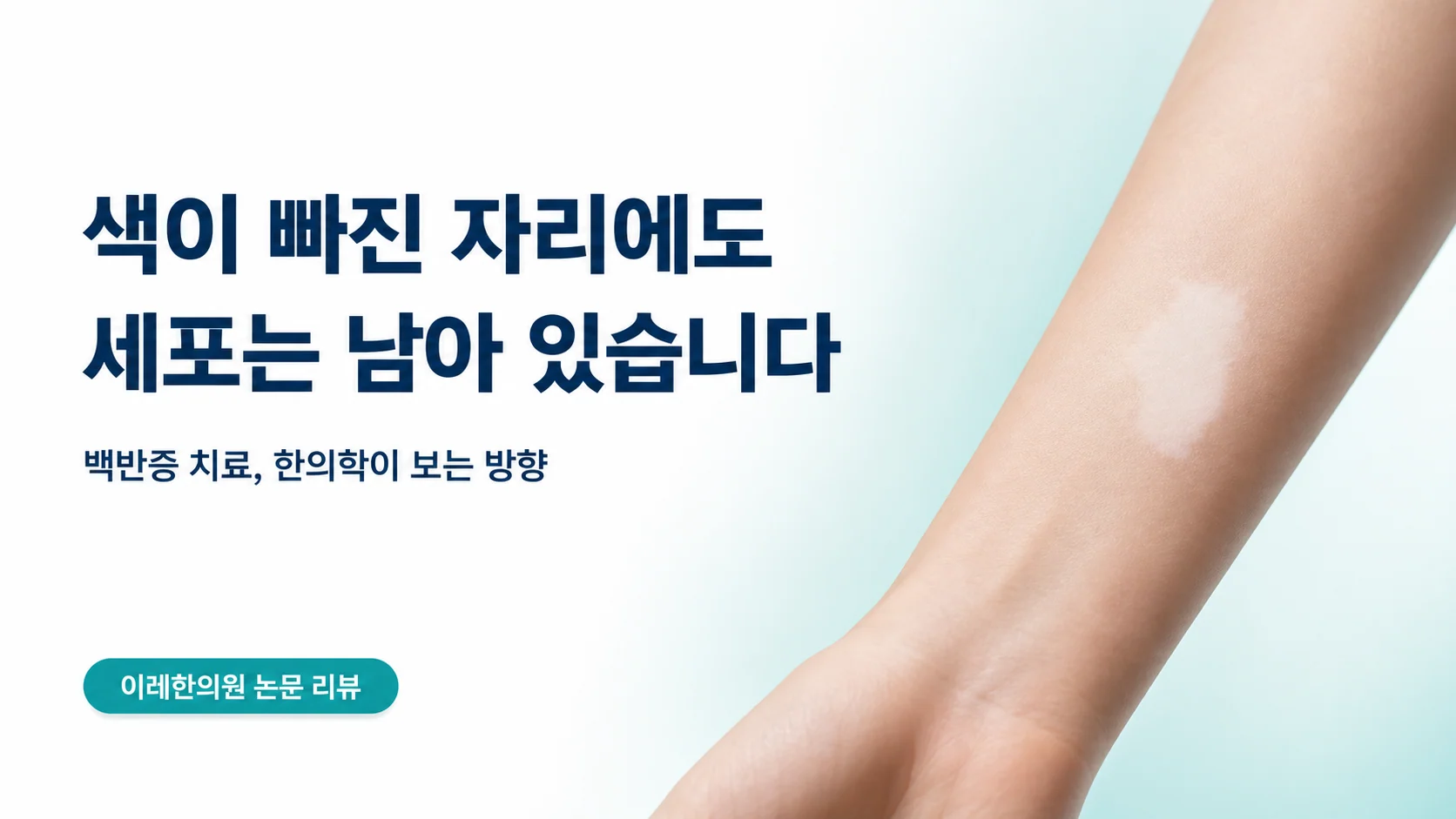 백반증 — 색이 빠진 자리에도 세포는 남아 있습니다