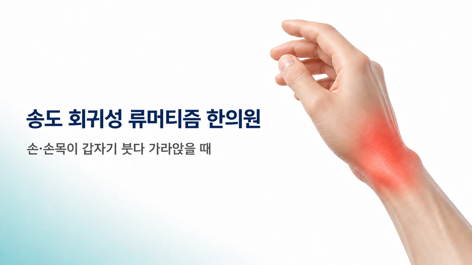 회귀성 류머티즘 — 손·손목이 갑자기 붓다 가라앉을 때