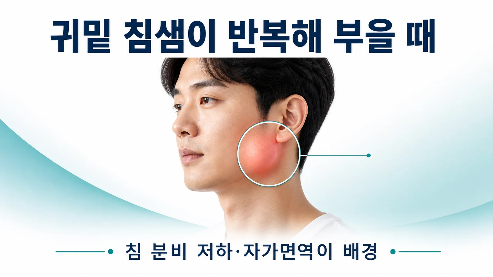 귀밑 침샘이 반복해 부을 때