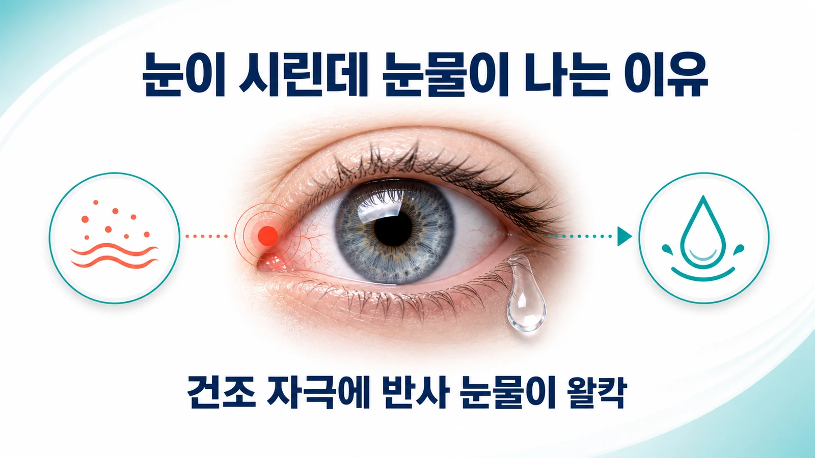 눈이 시린데 눈물이 나는 이유