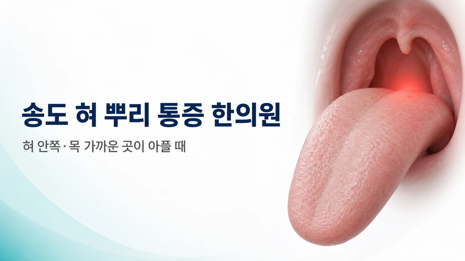 혀 뿌리 통증 — 혀 안쪽·목 가까운 곳이 아플 때 치료