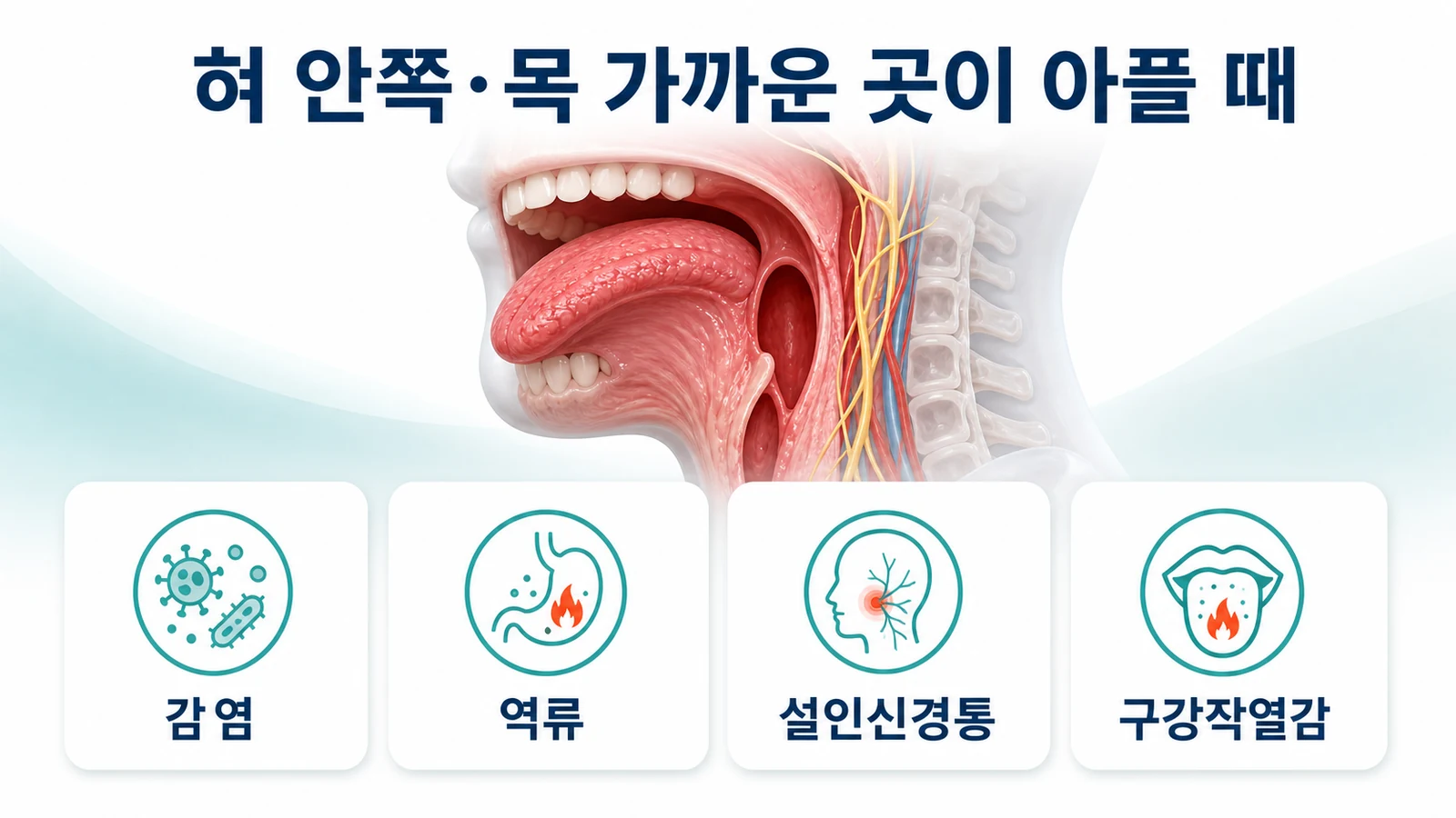 혀 안쪽·목 가까운 곳이 아플 때
